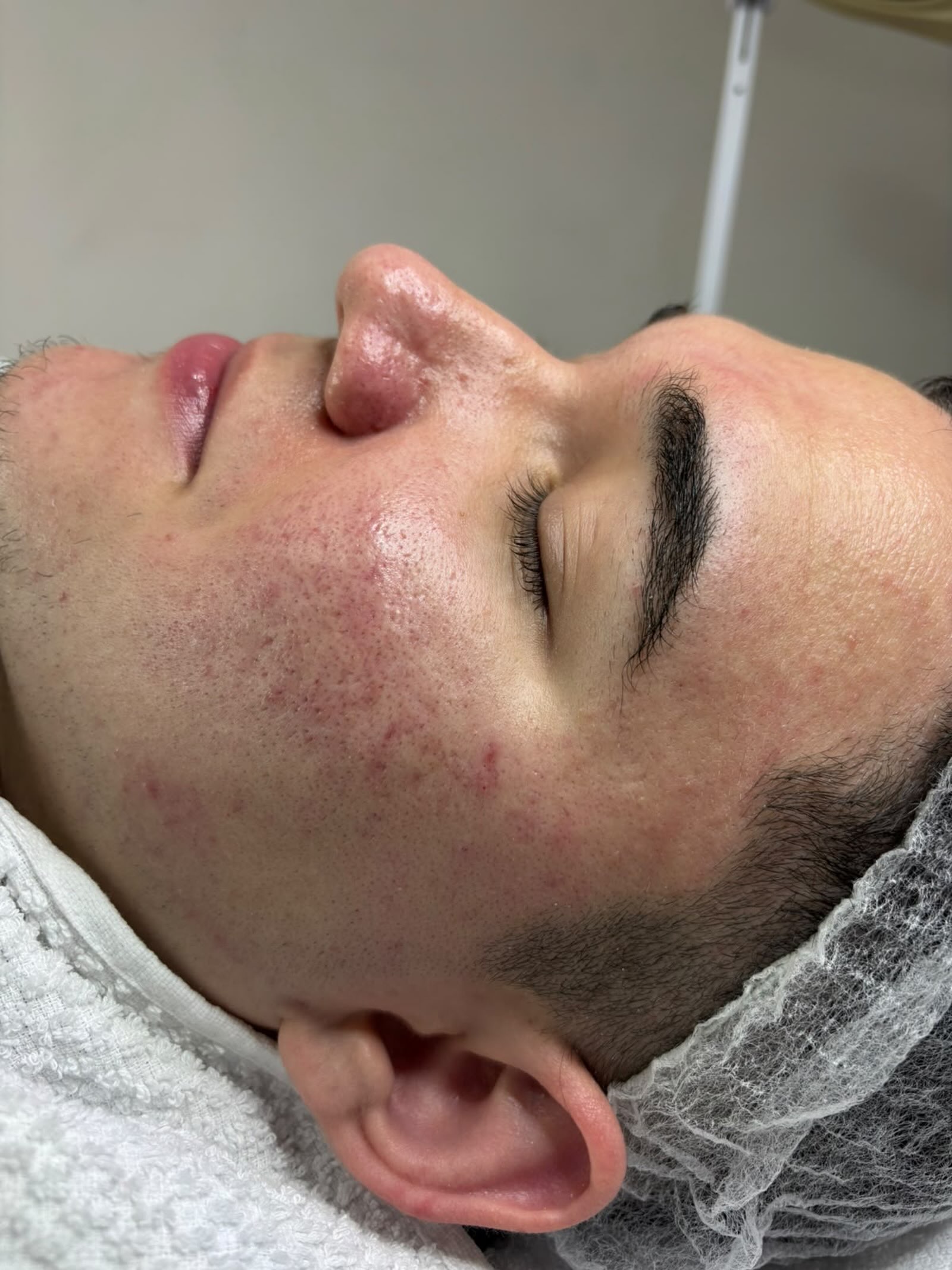 Limpeza de pele